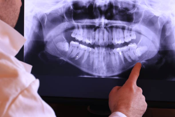 Best Emergency Treatment for Oral Infections in Fort Shawnee, OH